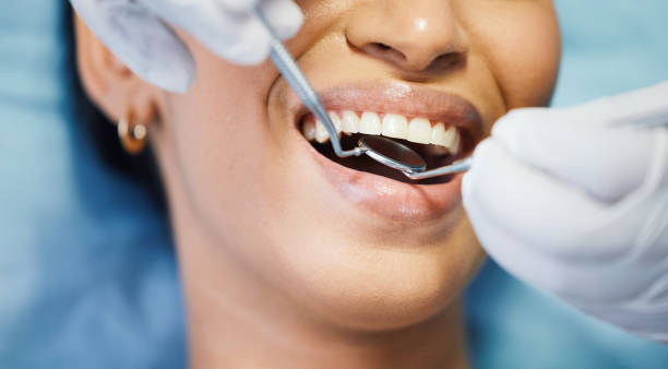 Best Emergency Wisdom Teeth Removal in Raleigh Hills, OR